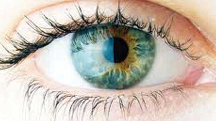 ‘K%C3%B6k%E2%80%99ten+retina+%C4%B1%C5%9F%C4%B1%C4%9F%C4%B1