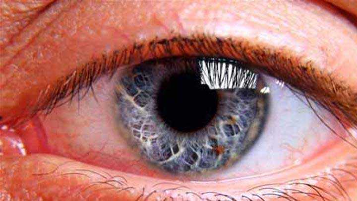 Retina+y%C4%B1rt%C4%B1klar%C4%B1