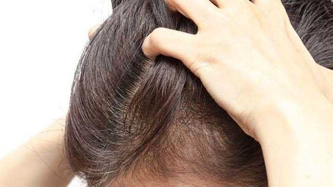 Beyaz+sa%C3%A7%C4%B1+do%C4%9Fal+rengine+%C3%A7eviren+ev+yap%C4%B1m%C4%B1+maske