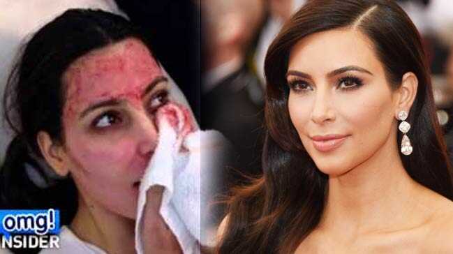Kim+Kardashian%E2%80%99%C4%B1n+%E2%80%99gen%C3%A7lik+form%C3%BCl%C3%BC%E2%80%99+T%C3%BCrkiye%E2%80%99ye+geldi