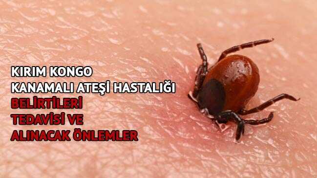 Hemorajik ateş: belirtiler, hastalığın nedenleri Hemorajik ateş: belirtiler, hastalığın nedenleri