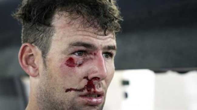 Cavendish%E2%80%99ten+korkutan+kaza
