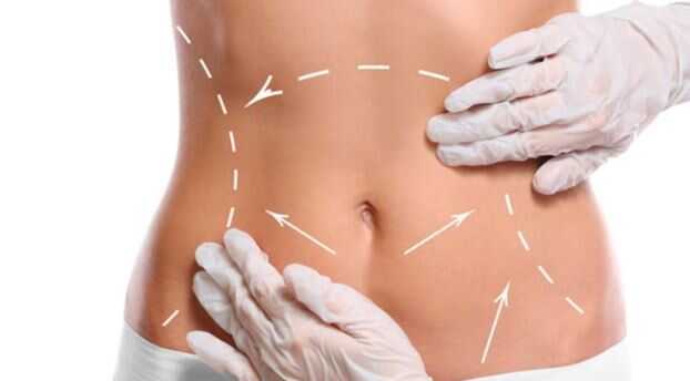 Liiposuction+nedir,+en+uygun+mevsim+ne+zamand%C4%B1r?